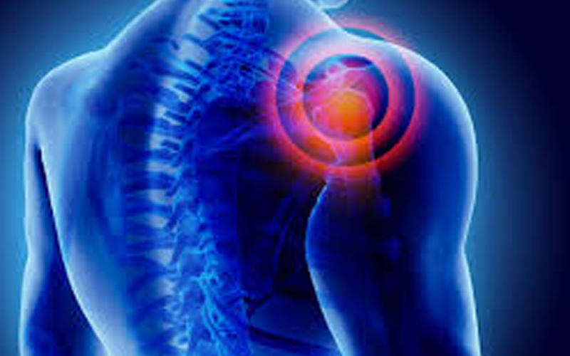 Shoulder Pain